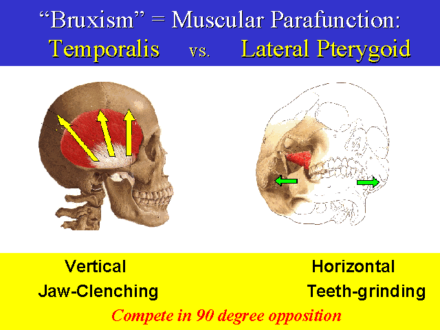 grinding teeth night headache